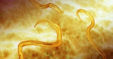 moth parasites in the human body