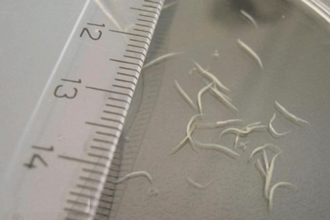 how to remove worms from a child