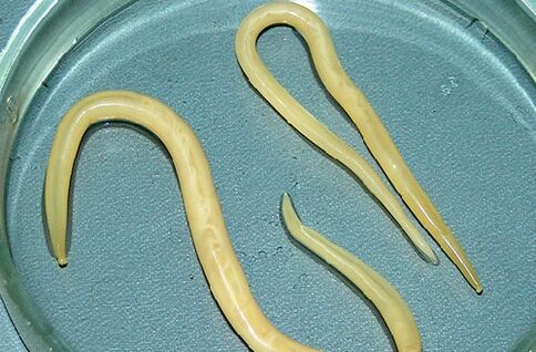 roundworms of a child's body