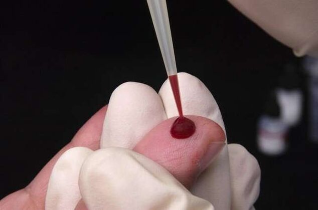 drawing blood for parasite analysis