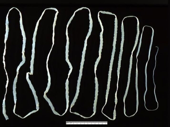 Bovine tapeworm enters a person through meat