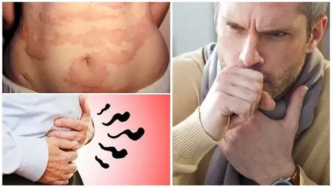 Allergies, coughing and bloating are signs of damage to the body by worms